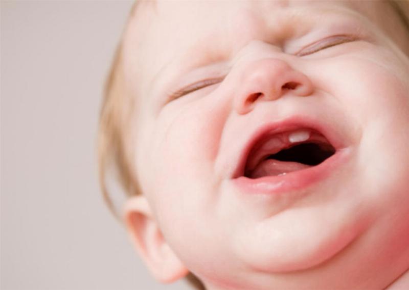 Hình ảnh bé mọc răng sữa đầu tiên nhú lên từ lợi, cột mốc quan trọng trong sự phát triển của trẻ
