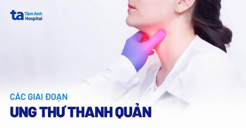 Hình ảnh minh họa giai đoạn sau can