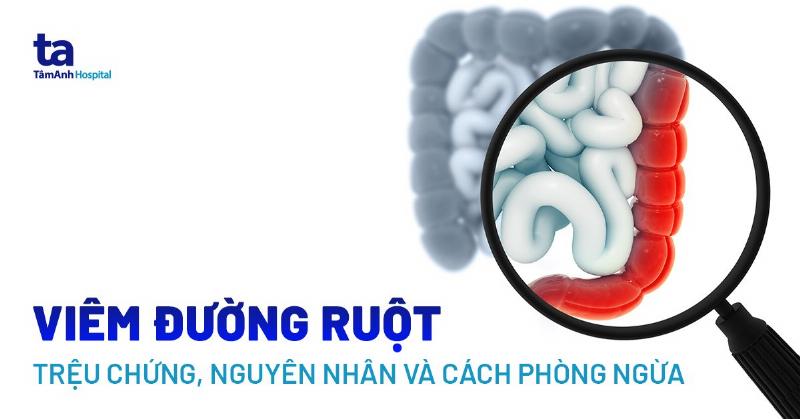 Hình minh họa hệ tiêu hóa được cải thiện, với các cơ quan tiêu hóa (dạ dày, ruột) khỏe mạnh, xung quanh là lá đinh lăng