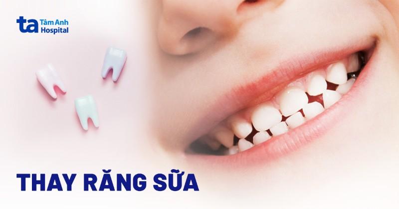 Hinh anh minh hoa thu tu va thoi gian uoc tinh moc cac loai rang sua cua tre nho