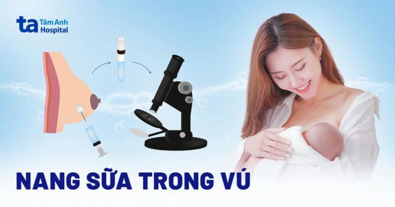 Hình ảnh minh họa việc sử dụng một lượng nhỏ dầu hoặc kem khi massage ngực bị tắc sữa