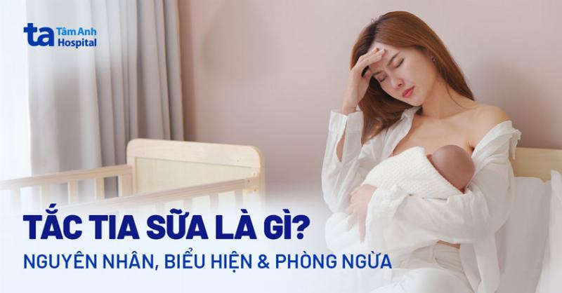 Tắc tia sữa bên phải