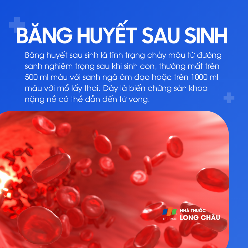 Hình ảnh minh họa tử cung mất trương lực, nguyên nhân chính gây băng huyết sau sinh nghiêm trọng.
