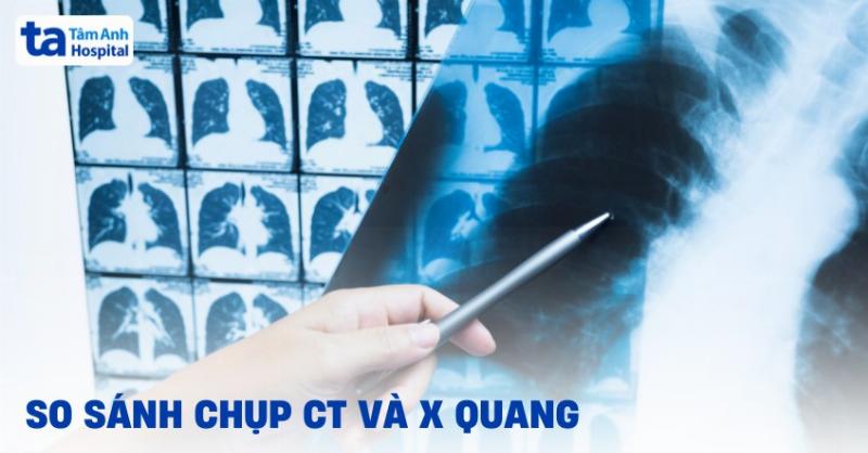 anh-chup-x-quang-va-ct-scanner