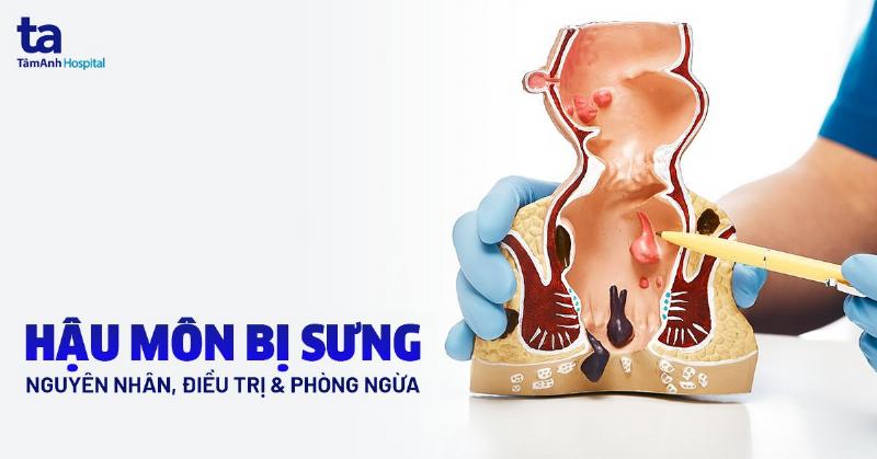 Hình ảnh minh họa vùng bụng dưới nơi có thể xuất hiện cảm giác đau sau khi quan hệ tình dục